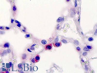 Human, Lung, Type 2 pneumocytes: Formalin-Fixed Paraffin-Embedded (FFPE)