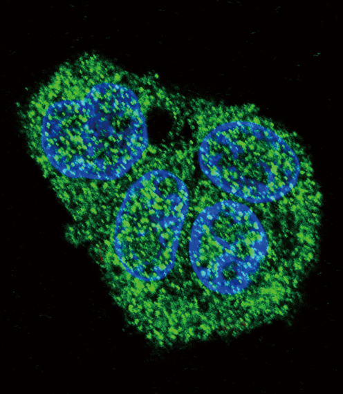 Confocal immunofluorescent of SFTPC Antibody with HepG2 cell followed by Alexa Fluor 488-conjugated goat anti-rabbit lgG (green). DAPI was used to stain the cell nuclear (blue).