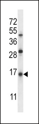 SFTPC Antibody western blot of Jurkat cell line lysates (35 ug/lane). The SFTPC antibody detected the SFTPC protein (arrow).
