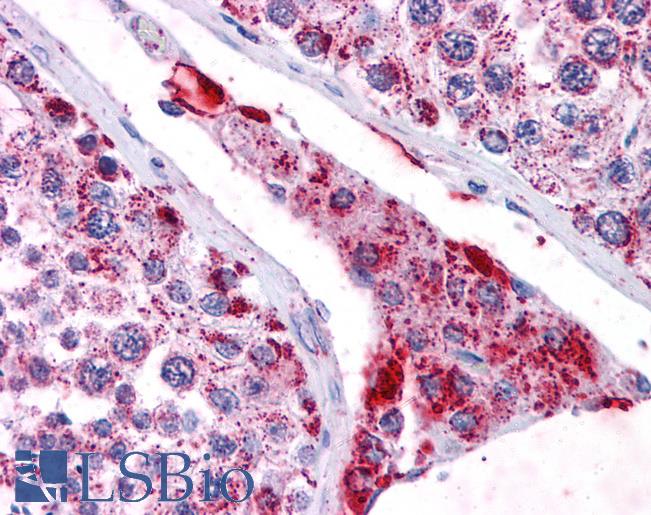 Anti-SFTPC / SP-C antibody IHC of human testis. Immunohistochemistry of formalin-fixed, paraffin-embedded tissue after heat-induced antigen retrieval. Antibody LS-B4588 concentration 5 ug/ml.