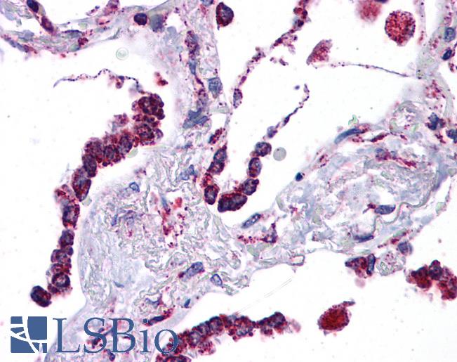 Anti-SFTPC / SP-C antibody IHC of human lung. Immunohistochemistry of formalin-fixed, paraffin-embedded tissue after heat-induced antigen retrieval. Antibody LS-B4588 concentration 5 ug/ml.