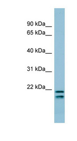 SFTPC / SP-C antibody LS-B4588 Western blot of COLO205 cell lysate.