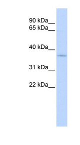 SFXN3 antibody LS-C102350 Western blot of CCRF-CEM lysate.