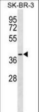 SFXN3 Antibody western blot of SK-BR-3 cell line lysates (35 ug/lane). The SFXN3 antibody detected the SFXN3 protein (arrow).
