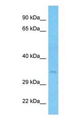 Western blot of SFXN3 Antibody with human Fetal Lung lysate.