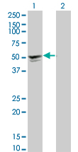 Western Blot analysis of SGCA expression in transfected 293T cell line by SGCA monoclonal antibody (M01), clone 3C4.Lane 1: SGCA transfected lysate(42.9 KDa).Lane 2: Non-transfected lysate.