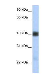 SGCB antibody LS-C102084 Western blot of Fetal Heart lysate.