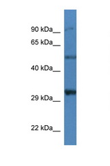 SGCD / Delta-Sarcoglycan antibody LS-C135158 Western blot of Mouse Kidney lysate. Antibody concentration 1 ug/ml.