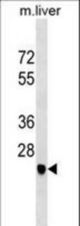 SGCD Antibody western blot of mouse liver tissue lysates (35 ug/lane). The SGCD antibody detected the SGCD protein (arrow).