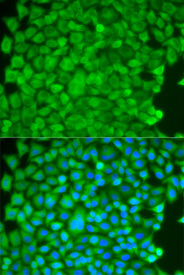 Immunofluorescence analysis of HeLa cell using SGCE antibody. Blue: DAPI for nuclear staining.