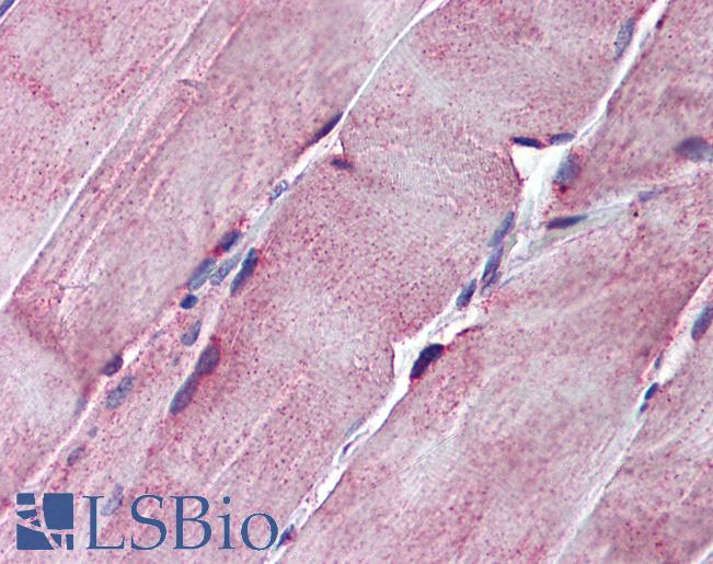 Anti-SGCE antibody IHC of human skeletal muscle. Immunohistochemistry of formalin-fixed, paraffin-embedded tissue after heat-induced antigen retrieval. Antibody LS-B5795 concentration 5 ug/ml.