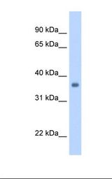 Fetal heart cell lysate. Antibody concentration: 1.25 ug/ml. Gel concentration: 12%.