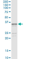 Immunoprecipitation of SGCG transfected lysate using anti-SGCG monoclonal antibody and Protein A Magnetic Bead, and immunoblotted with SGCG rabbit polyclonal antibody.