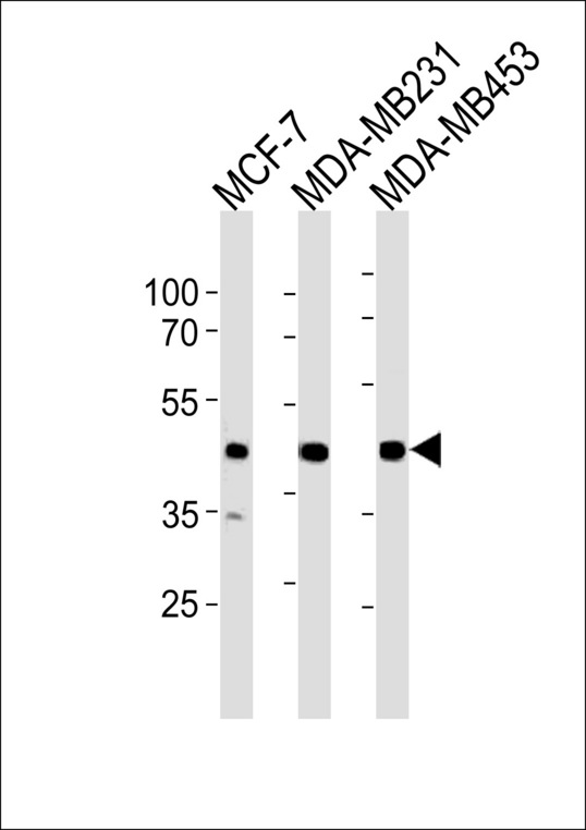 SGCG Antibody western blot of MCF-7,MDA-MB231,MDA-MB453 cell line lysates (35 ug/lane). The SGCG antibody detected the SGCG protein (arrow).