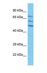 Western blot of SGIP1 Antibody with human HepG2 Whole Cell lysate.