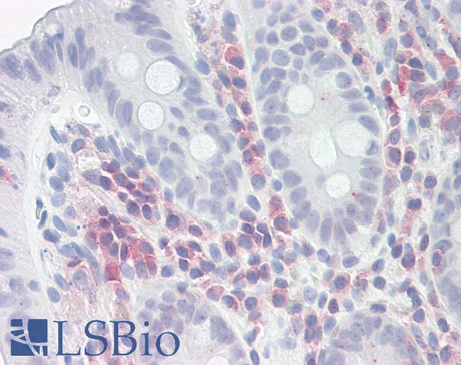 Anti-PSME1 antibody IHC of human colon. Immunohistochemistry of formalin-fixed, paraffin-embedded tissue after heat-induced antigen retrieval. Antibody LS-B8233 dilution 5-7.5 ug/ml.