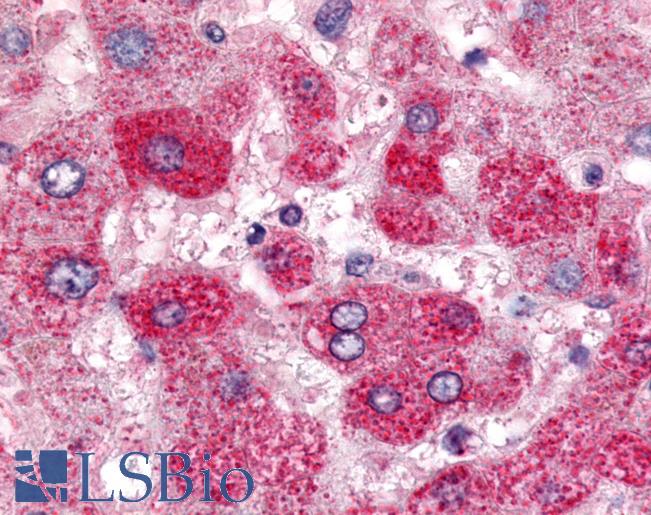 Anti-SGK2 antibody IHC of human liver. Immunohistochemistry of formalin-fixed, paraffin-embedded tissue after heat-induced antigen retrieval. Antibody LS-A7221 dilution 7 ug/ml.