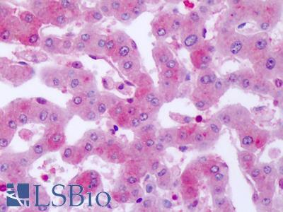 Anti-SGK2 antibody IHC of human liver. Immunohistochemistry of formalin-fixed, paraffin-embedded tissue after heat-induced antigen retrieval. Antibody LS-A7218 dilution 1 ug/ml.