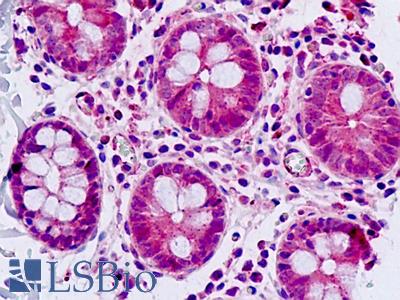 Human, Small Intestine: Formalin-Fixed Paraffin-Embedded (FFPE)