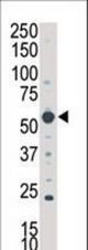 Western blot of anti-SKG3 antibody in A375 cell lysate. SGK3 (arrow) was detected using purified antibody. Secondary HRP-anti-rabbit was used for signal visualization with chemiluminescence.