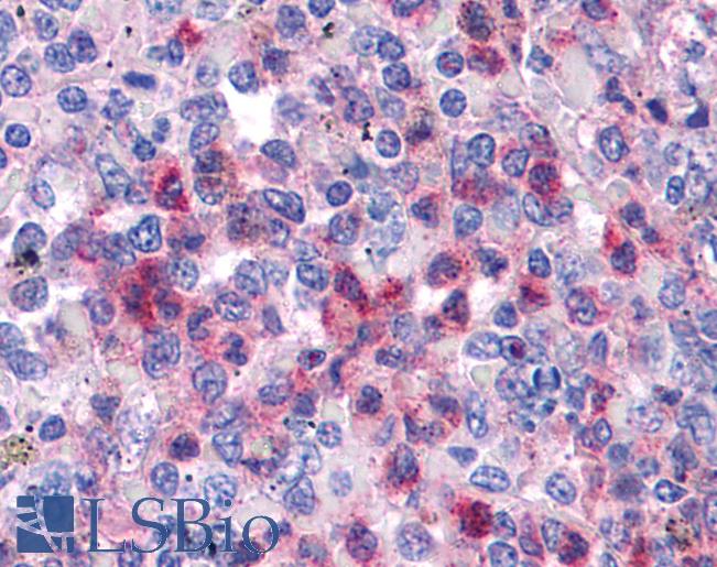 Anti-SGK3 antibody IHC of human spleen. Immunohistochemistry of formalin-fixed, paraffin-embedded tissue after heat-induced antigen retrieval. Antibody LS-B4684 concentration 5 ug/ml.