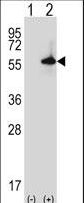 Western blot of Sgk3 (arrow) using rabbit polyclonal Mouse Sgk3 Antibody. 293 cell lysates (2 ug/lane) either nontransfected (Lane 1) or transiently transfected (Lane 2) with the Sgk3 gene.