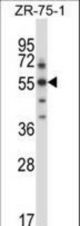 Mouse Sgk3 Antibody western blot of ZR-75-1 cell line lysates (35 ug/lane). The Sgk3 antibody detected the Sgk3 protein (arrow).