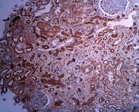 Human kidney section stained with anti-SMS-1 antibody (LS-C140565) at 2 ug/ml. Anti-rabbit Ig H+L HRP conjugate (5 ug/ml) without antigen retrieval.