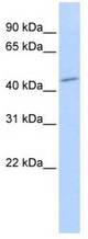 Western analysis of Hela cell lysate.