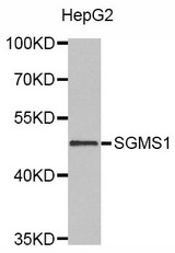 Western blot analysis of extracts of HepG2 cell line, using SGMS1 antibody.