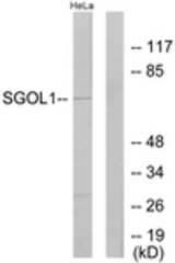 Western blot of extracts from HeLa cells, using SGOL1 Antibody. The lane on the right is treated with the synthesized peptide.