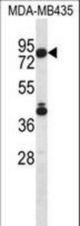 SGPL1 Antibody western blot of MDA-MB435 cell line lysates (35 ug/lane). The SGPL1 antibody detected the SGPL1 protein (arrow).