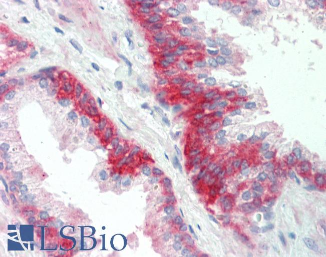 Anti-SGPP1 antibody IHC staining of human prostate. Immunohistochemistry of formalin-fixed, paraffin-embedded tissue after heat-induced antigen retrieval.