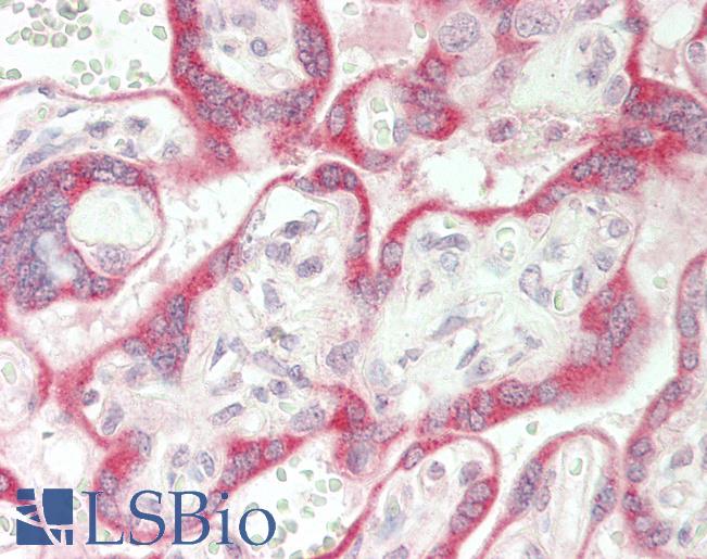 Human Placenta: Formalin-Fixed, Paraffin-Embedded (FFPE)