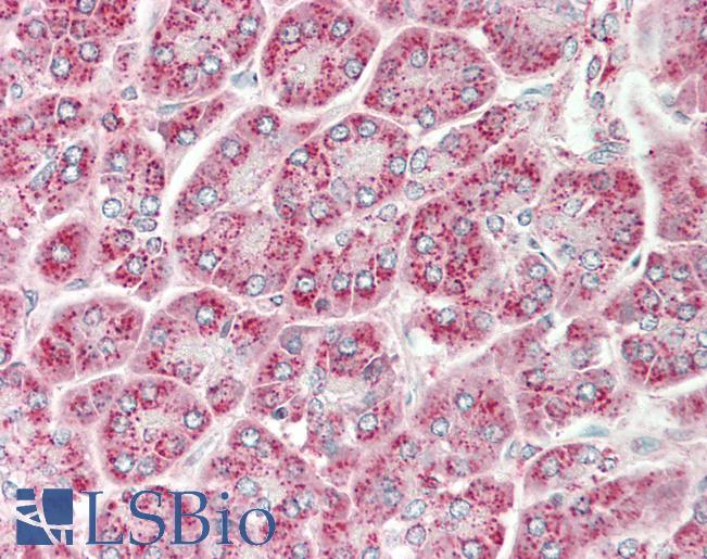 Human Pancrease: Formalin-Fixed, Paraffin-Embedded (FFPE)