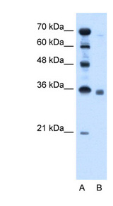 SGPP2 antibody LS-C40533 Western blot of HepG2 cell lysate.