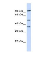 Western blot of Human 721_B. SGSH antibody dilution 1.0 ug/ml.