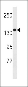 SGSM1 Antibody western blot of MDA-MB453 cell line lysates (35 ug/lane). The SGSM1 antibody detected the SGSM1 protein (arrow).