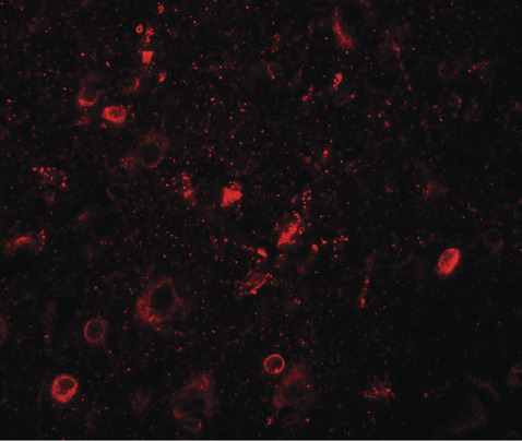 Immunofluorescence of SGSM1 in human brain tissue with SGSM1 antibody at 20 ug/ml.