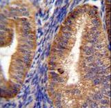 RUTBC1 Antibody immunohistochemistry of formalin-fixed and paraffin-embedded human uterus tissue followed by peroxidase-conjugated secondary antibody and DAB staining.