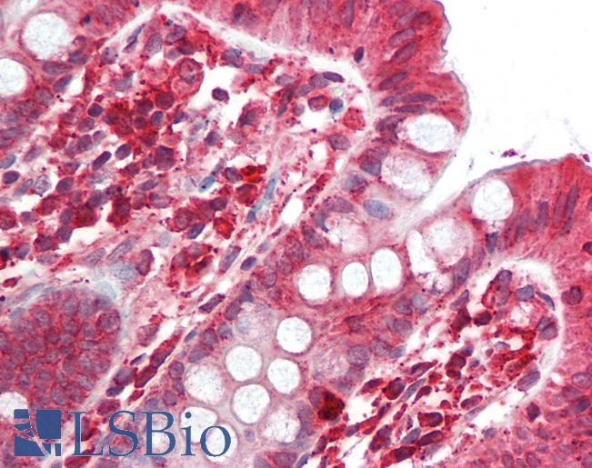 Anti-SGSM2 antibody IHC staining of human colon. Immunohistochemistry of formalin-fixed, paraffin-embedded tissue after heat-induced antigen retrieval.
