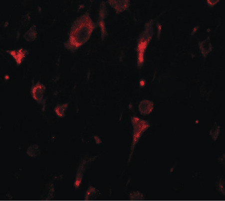 Immunofluorescence of SGSM2 in human brain tissue with SGSM2 antibody at 20 ug/ml.