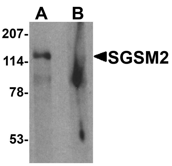 Western blot analysis of SGSM2 in human cerebellum tissue lysate with SGSM2 antibody at 1 ug/ml in (A) the absence and (B) the presence of blocking peptide