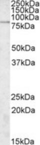 RUTBC3 antibody (2 ug/ml) staining of A549 lysate (35 ug protein/ml in RIPA buffer). Primary incubation was 1 hour. Detected by chemiluminescence.