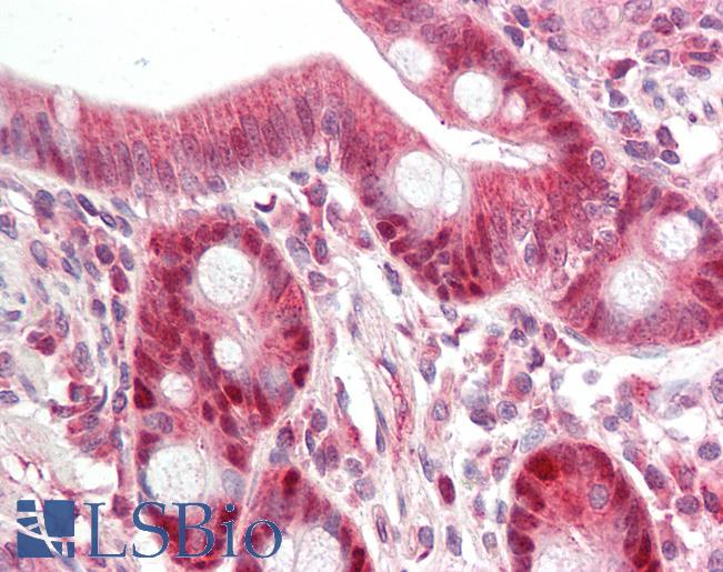 Anti-SGSM3 antibody IHC staining of human small intestine. Immunohistochemistry of formalin-fixed, paraffin-embedded tissue after heat-induced antigen retrieval.