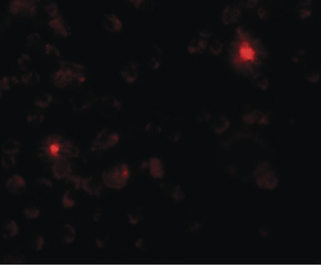 Immunofluorescence of SGSM3 in 293 cells with SGSM3 antibody at 20 ug/ml.