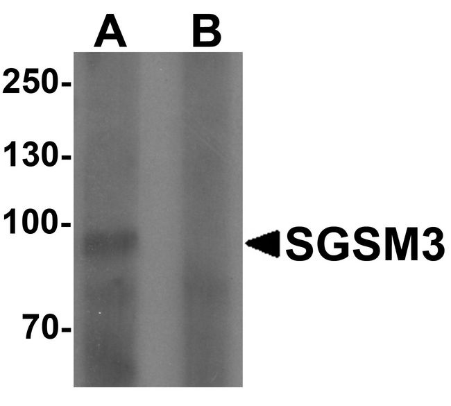 Western blot analysis of SGSM3 in 293 cell lysate with SGSM3 antibody at (A) 1 and (B) 2 ug/ml.