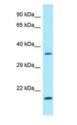 SGTA / SGT antibody Western Blot of Fetal Heart.
