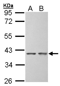 Sample (30 ug of whole cell lysate). A: Hep G2 , B: Molt-4 . 10% SDS PAGE. SGTA / SGT antibody diluted at 1:5000.