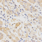 Immunohistochemistry of paraffin-embedded human stomach using SH2B1 antibody at dilution of 1:200 (x400 lens)